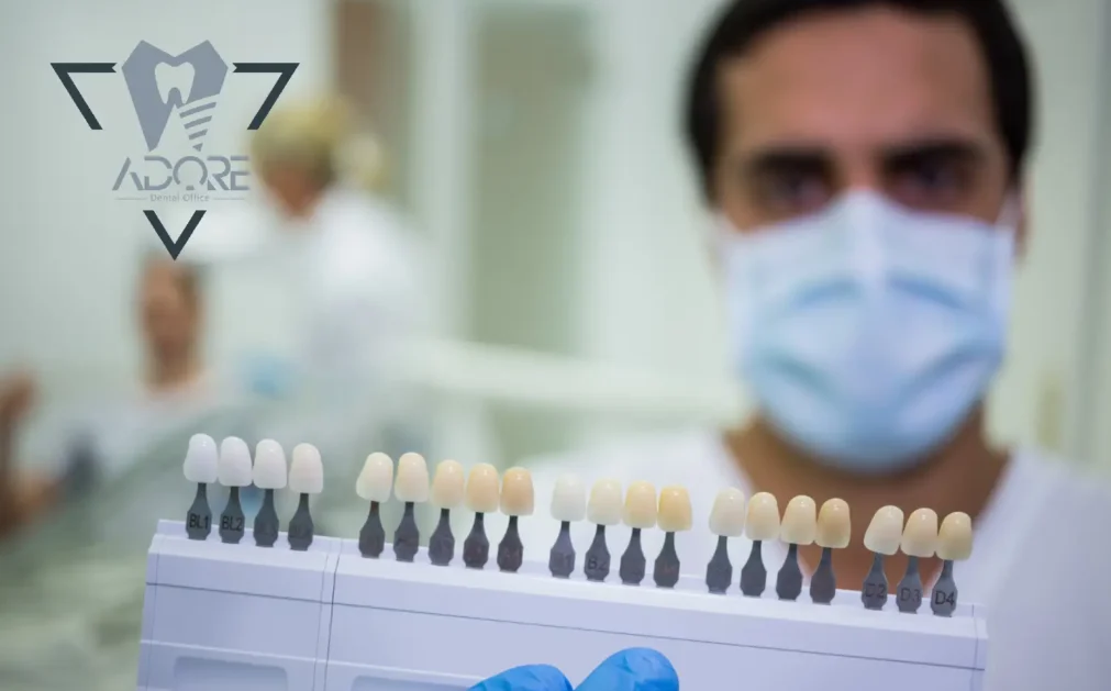 راهنمای کامل ایمپلنت اشترومن 🦷 چرا ایمپلنت اشترومن انتخاب کنیم؟